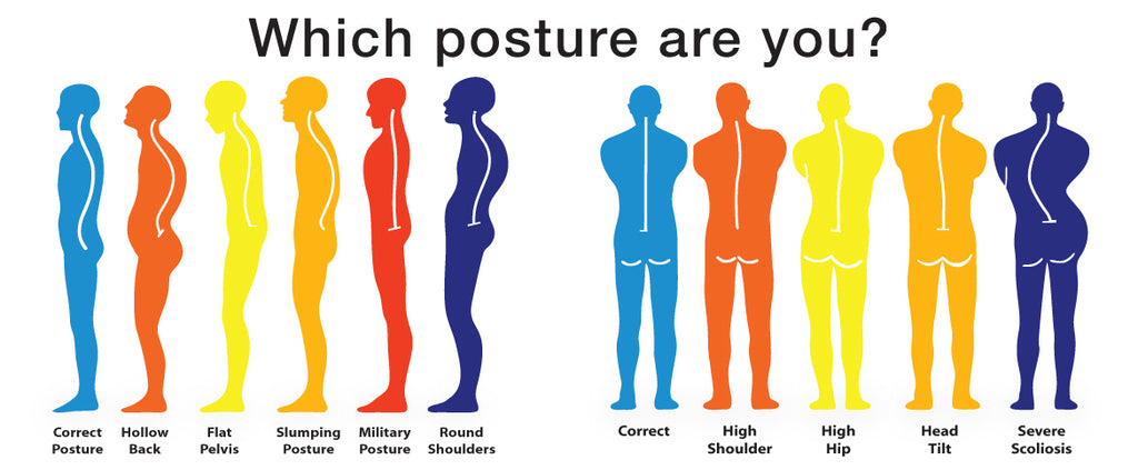 Can Back Braces Help Improve Posture And Do They Really Work To Correct Bad Posture?